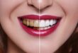 Dentifricio che Sbianca i Denti